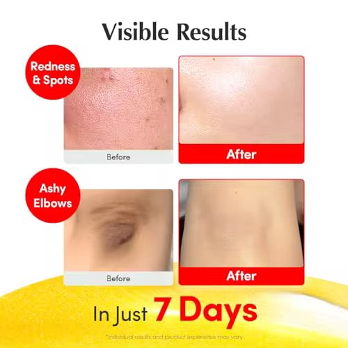 Psoralea Corylifolia Phenol Plumping Vitamin Serum